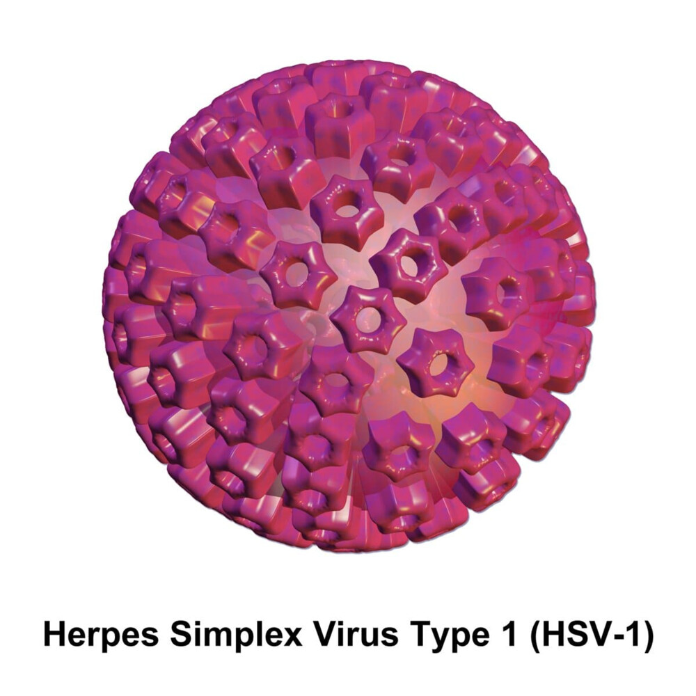 Herpes simple I Ac.IgM Estudios Analíticos aplicados a la clínica